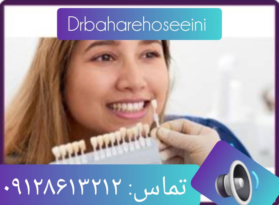 ۱۰ نکته طلایی برای کامپوزیت دندان و مراحل کامپوزیت